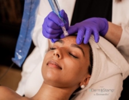 Dermastamp Skin Needling